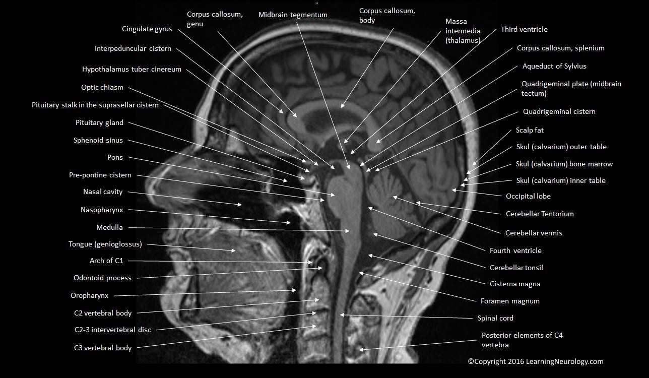 Cross sectional and imaging anatomy of the thorax YouTube